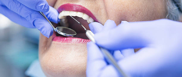 Best Dentist for Tooth Abscess  in St Croix Falls, WI